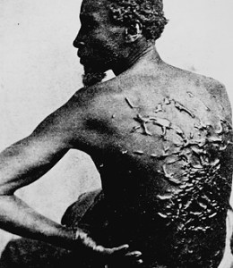 slavery_scars